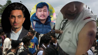 प्रहरीको गोली लागेर दुई पत्रकार घाइते, एक जनालाई सामान्य चोट